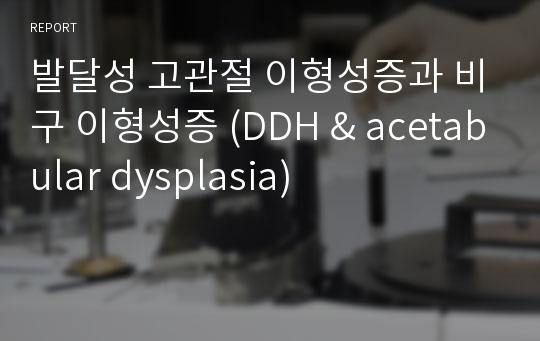 발달성 고관절 이형성증과 비구 이형성증 (DDH &amp; acetabular dysplasia)