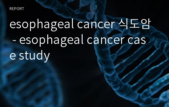 esophageal cancer 식도암 - esophageal cancer case study