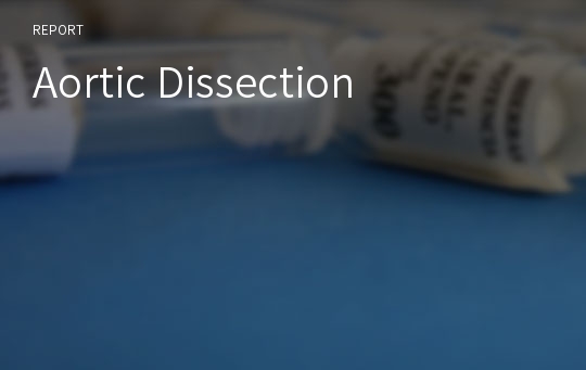 Aortic Dissection