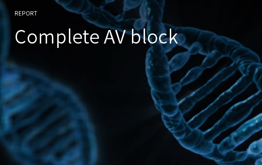 Complete AV block