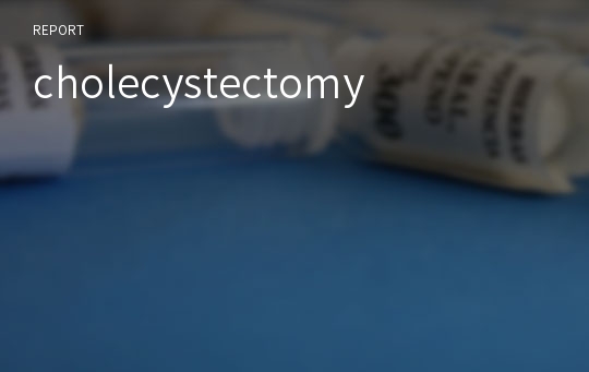 cholecystectomy