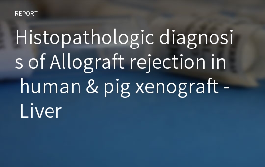 Histopathologic diagnosis of Allograft rejection in human &amp; pig xenograft - Liver