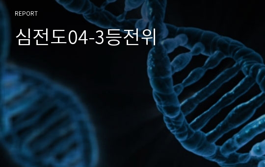 심전도04-3등전위