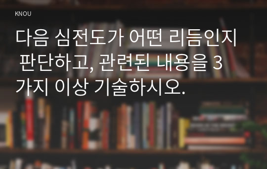 다음 심전도가 어떤 리듬인지 판단하고, 관련된 내용을 3가지 이상 기술하시오.