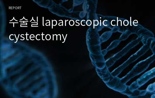 수술실 laparoscopic cholecystectomy