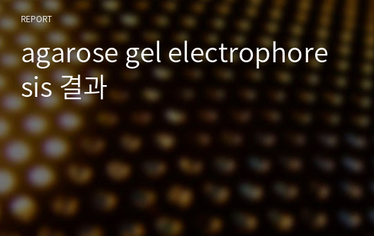 agarose gel electrophoresis 결과