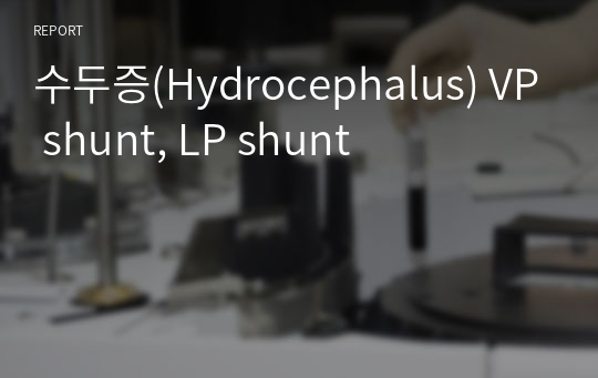 수두증(Hydrocephalus) VP shunt, LP shunt