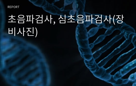 초음파검사, 심초음파검사(장비사진)