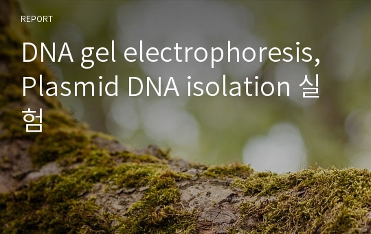 DNA gel electrophoresis, Plasmid DNA isolation 실험