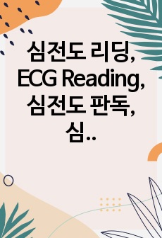 심전도 리딩, ECG Reading, 심전도 판독, 심전도 검사